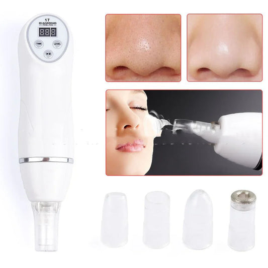 Electric Pore Suction and Acne Removing Device